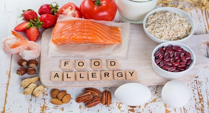 Food allergies